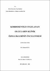 Küçük Resim