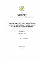Küçük Resim