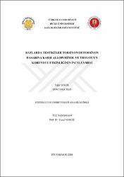 Küçük Resim