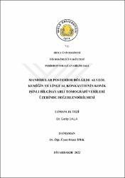 Küçük Resim
